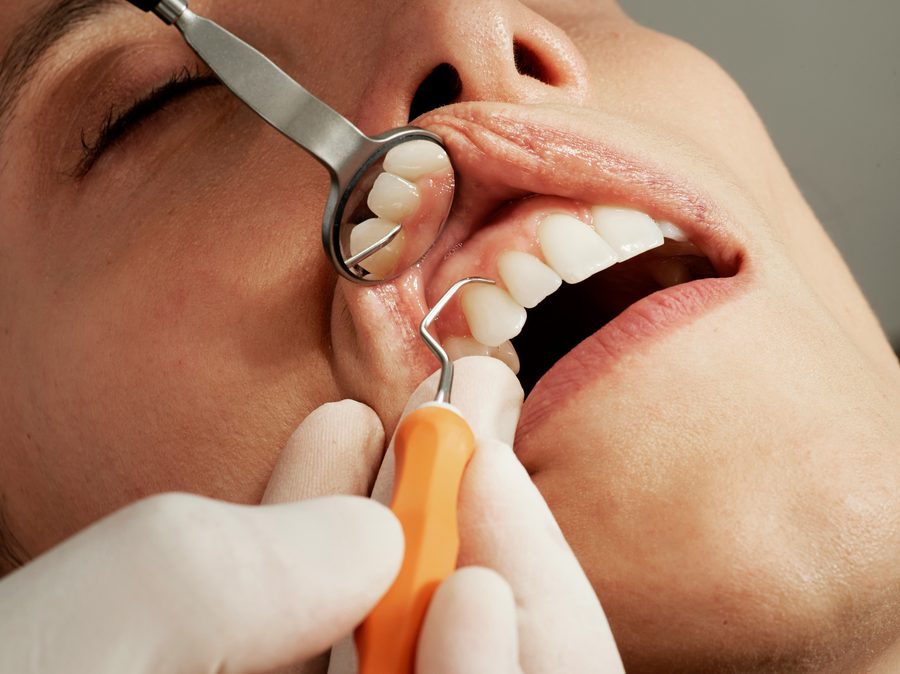 Gentle dental examination and care